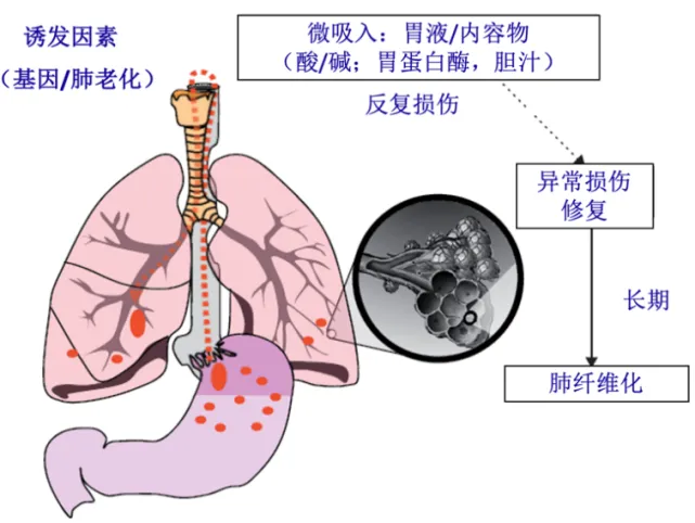 科(ke)研榦(gan)貨(huo) | 一(yi)站(zhan)式(shi)解決(jue)肺纖維(wei)化臨(lin)牀前(qian)動(dong)物(wu)研(yan)究，助(zhu)力(li)科(ke)學探(tan)索(suo)與(yu)創(chuang)新